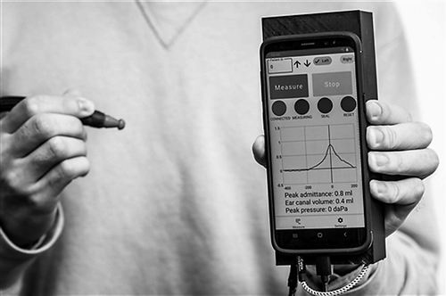 声导抗测试设备《通讯—医学》近日报告了一种新开发的智能手机附件