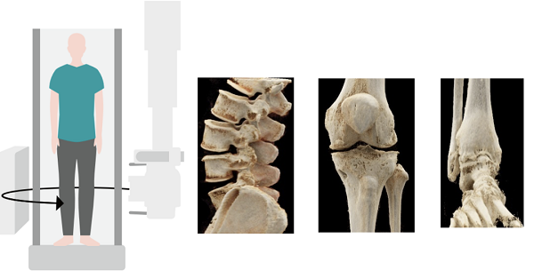 悬吊DR怎么安装价超64排CT 悬吊式CBCT-DR凭创新实力出界_https://www.jmylbn.com_新闻资讯_第8张