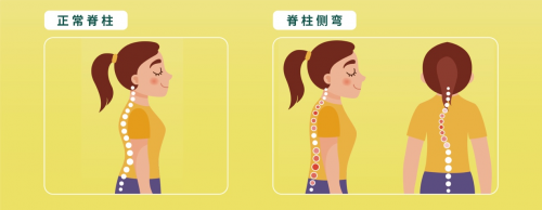 　　(图片来源于迪巧2019年“挺起未来的脊梁”公益活动宣教海报)