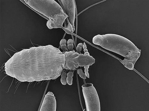 科学家发现第一只长虱子的哺乳动物
