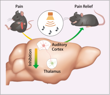 低强度声音通过抑制听皮层到躯体感觉丘脑的神经投射缓解小鼠疼痛的示意图 课题组供图