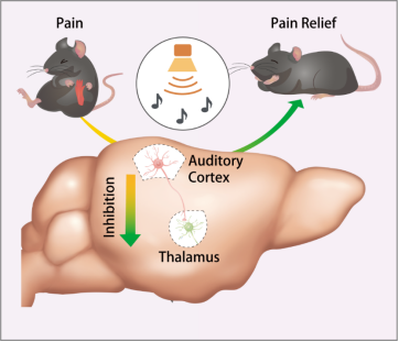 《科学》：科学家破译“声音”减轻疼痛的原因
