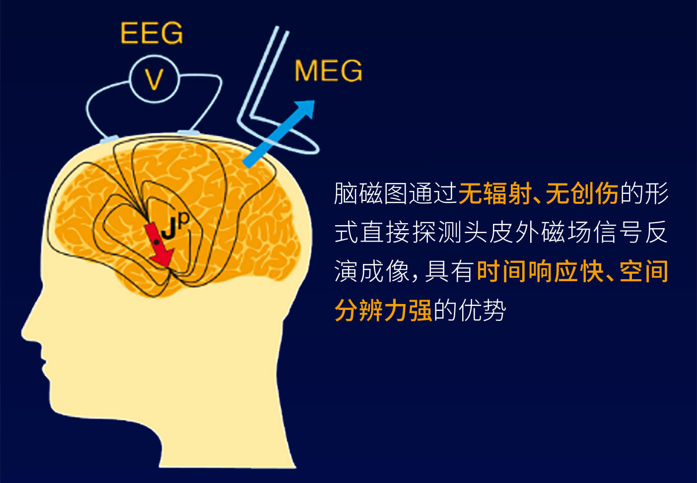 脑神经元放电后,电场传导到头皮会经过各种介质,脑脊液,白质,灰质