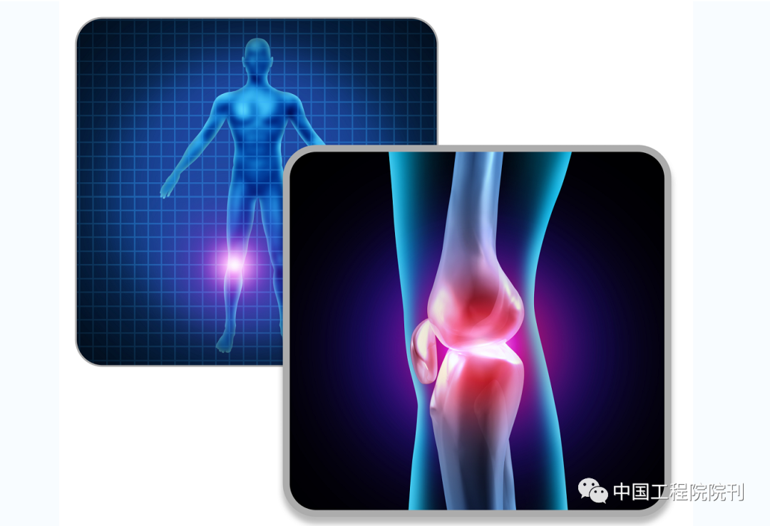 怎样的氨糖可以长期服用 Movefree不同颜色功效有什么不同