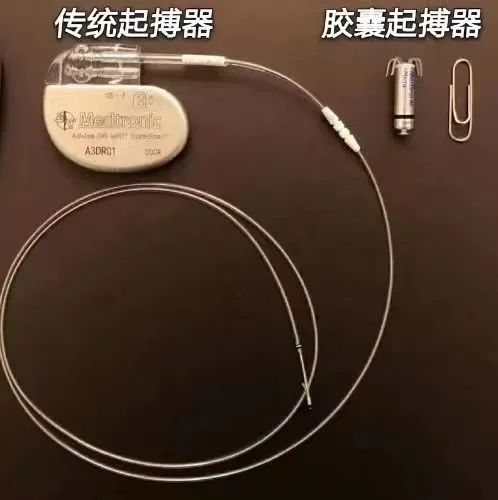 省内首例新一代双腔无导线起搏器植入