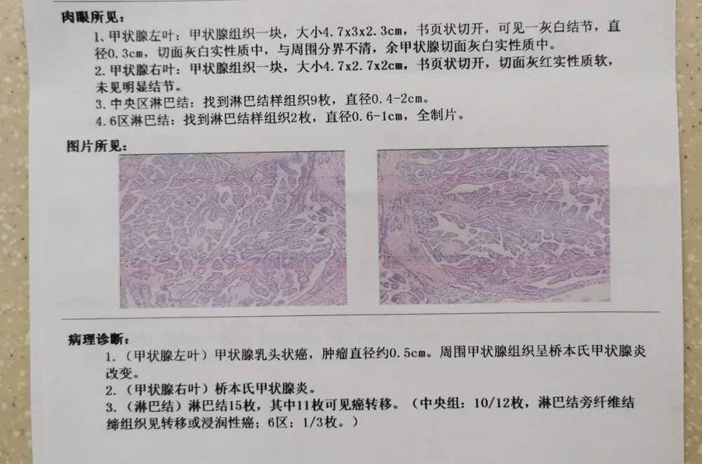 图 | 王波的诊断报告