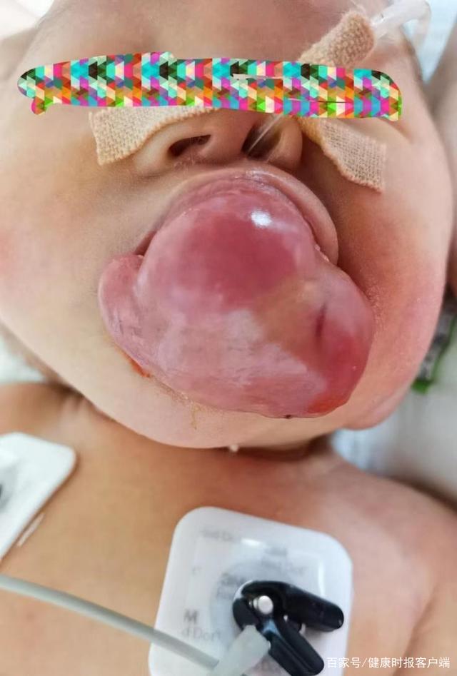 希希口腔内有红色赘生物.受访者供图