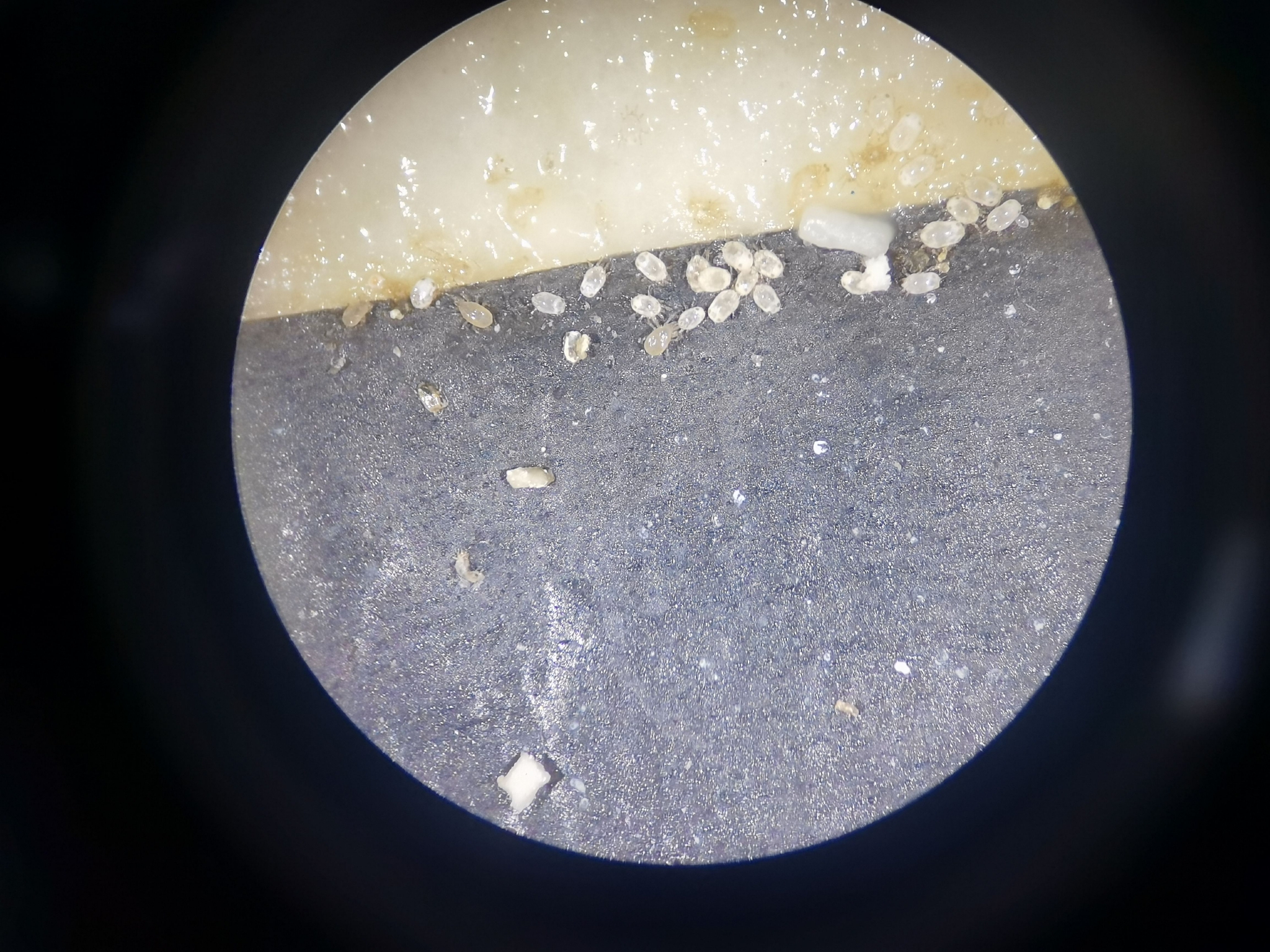 显微镜下捕食螨在猎食有害螨 .新京报记者 王颖 摄