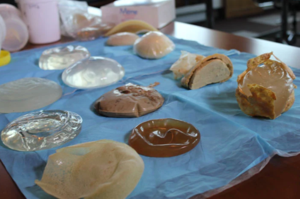 隆胸的反噬_新浪财经_新浪网