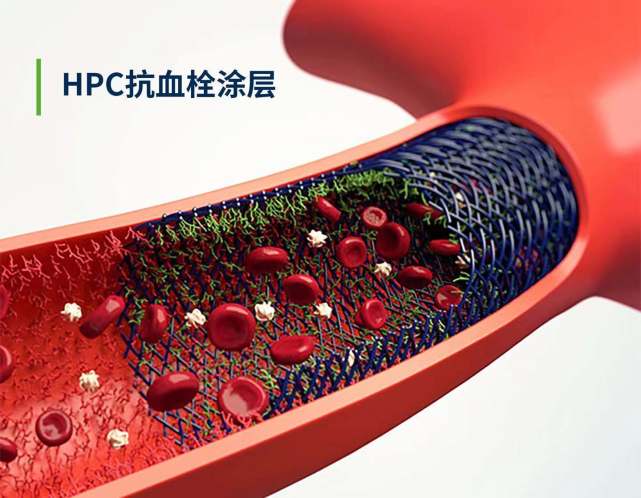 　　图注:全球首个专利HPC抗血栓涂层
