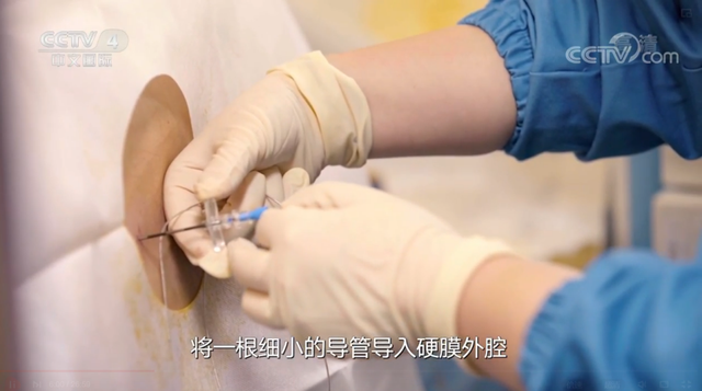 中国仅30%产妇使用无痛分娩