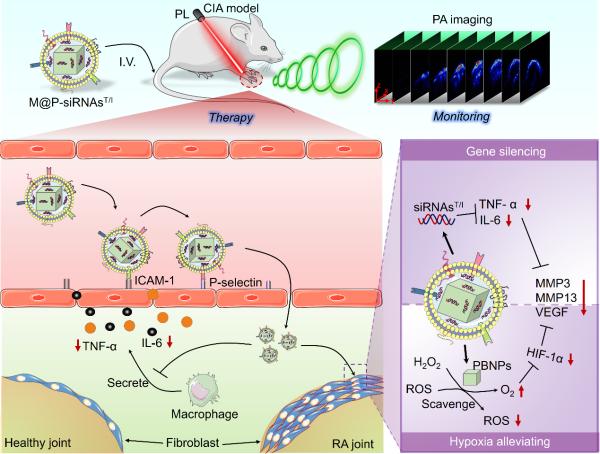 类风湿关节炎靶向诊疗研究示意图&nbsp