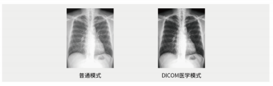 　　(支持DICOM医学模式)