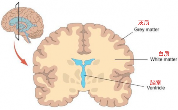 　　(大脑结构示意图，grey matter 灰质，white matter 白质， ventricle 脑室)