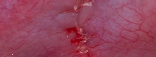 什么是显微镜手术西默牙科显微镜，牙医们的首选国产口腔显微镜品牌_https://www.jmylbn.com_新闻资讯_第17张