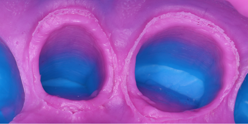 什么是显微镜手术西默牙科显微镜，牙医们的首选国产口腔显微镜品牌_https://www.jmylbn.com_新闻资讯_第20张