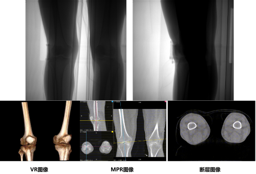 数字化摄影是什么检查安健科技重磅推出“WR-3D”新一代技术，引领动态潮流_https://www.jmylbn.com_新闻资讯_第3张
