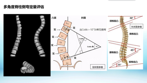 数字化摄影是什么检查安健科技重磅推出“WR-3D”新一代技术，引领动态潮流_https://www.jmylbn.com_新闻资讯_第4张