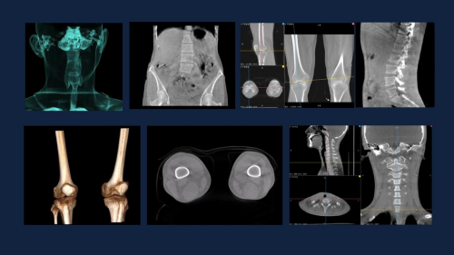 数字化摄影是什么检查安健科技重磅推出“WR-3D”新一代技术，引领动态潮流_https://www.jmylbn.com_新闻资讯_第6张