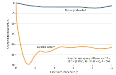 减肥手术多少钱_减肥手术有哪些方法_手术减肥
