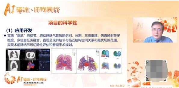 　　浙江省人民医院放射科主任医师、博士生导师龚向阳教授以《肺结节AI靶重建解决方案助力肺癌全周期精准诊疗》为题发表演讲