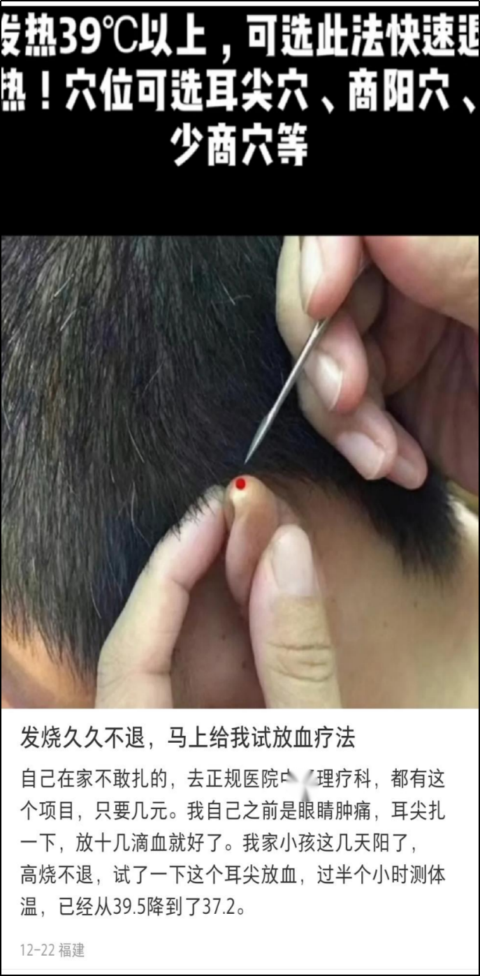 扎手的.放血是古今中外放之四海而皆准的奇术.