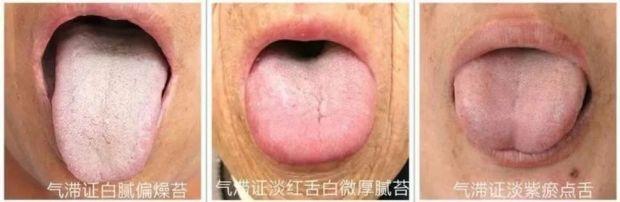 Jnfkzetqobylxm