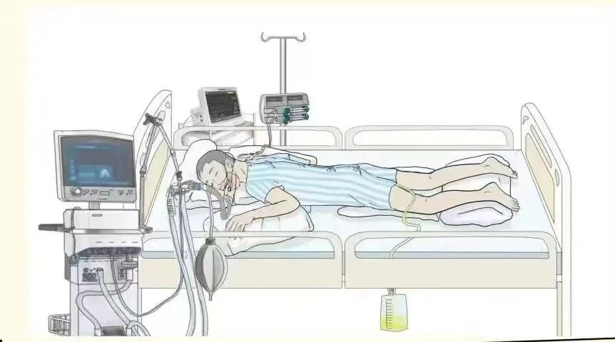 科普|得了新冠胸闷不舒服,俯卧位通气如何操作?