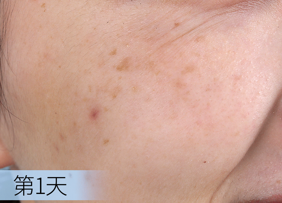 *使用效果因人而异