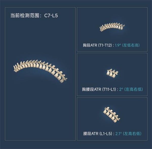 　　ATR 3D 脊柱报告
