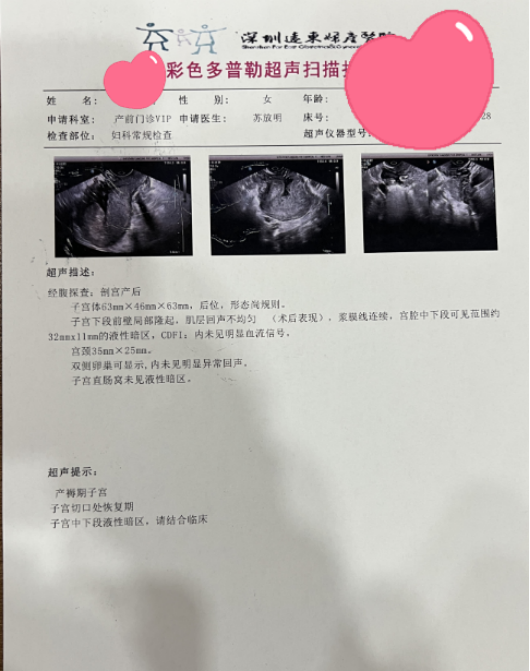 子宫破裂产妇命悬一线,多学科协作成功挽救母婴生命,保住子宫!