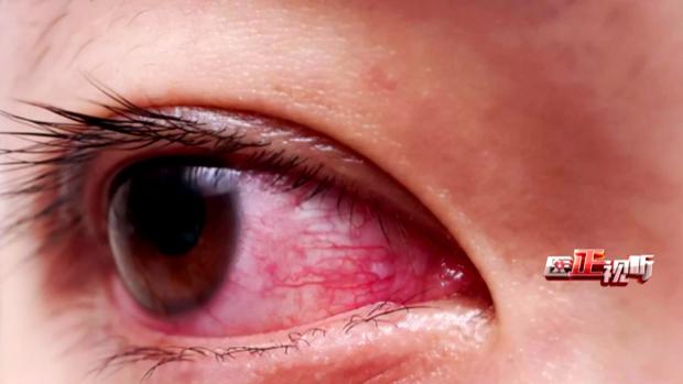 它是一层薄薄的透明的很疏松的组织,它的表面有很多毛细血管,如果这个