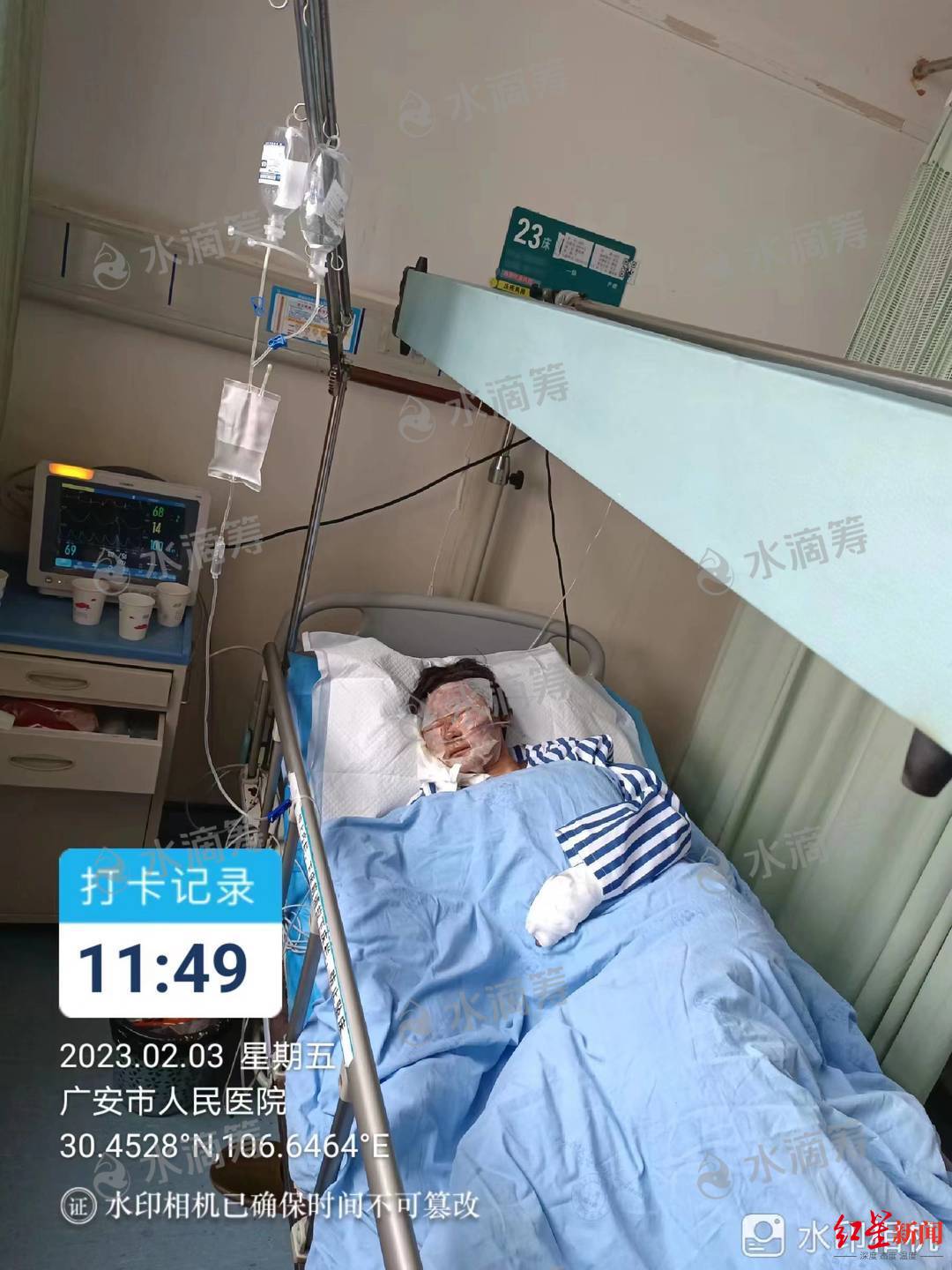 伤者在医院治疗 图片来自筹款平台