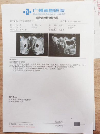 【广州报喜】输卵管粘连 宫腔粘连 卵巢间质细胞增生,经南粤治疗后