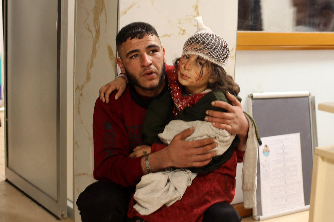 当地时间2月6日，叙利亚阿萨兹，一名受伤的小女孩在地震后正在医院等待治疗。图据视觉中国