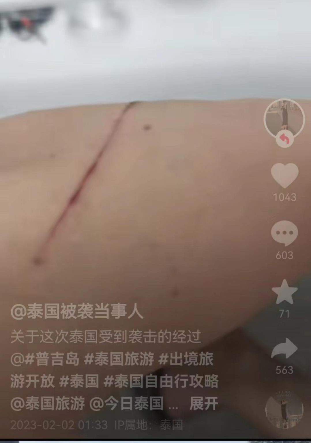 ↑乔女士在视频中称丈夫被旅行社工作人员割伤手臂 视频截图