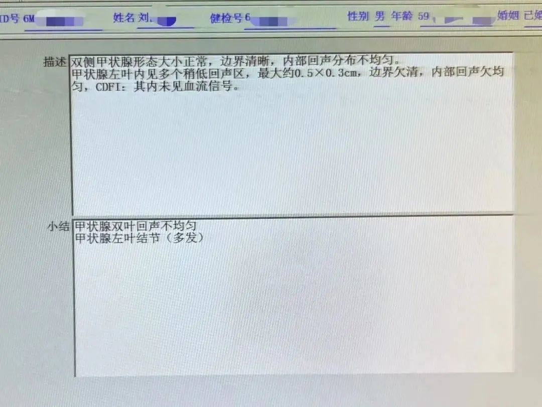 三访追击,揪出甲状腺"杀手"!|体检故事