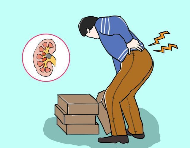 该如何治疗在泌尿外科急诊经常会遇见孕妇因为输尿管结石引发的肾绞痛