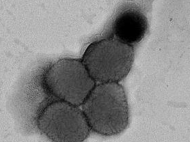 猴痘病毒电镜图截图 图片来源：武汉生物制品研究所