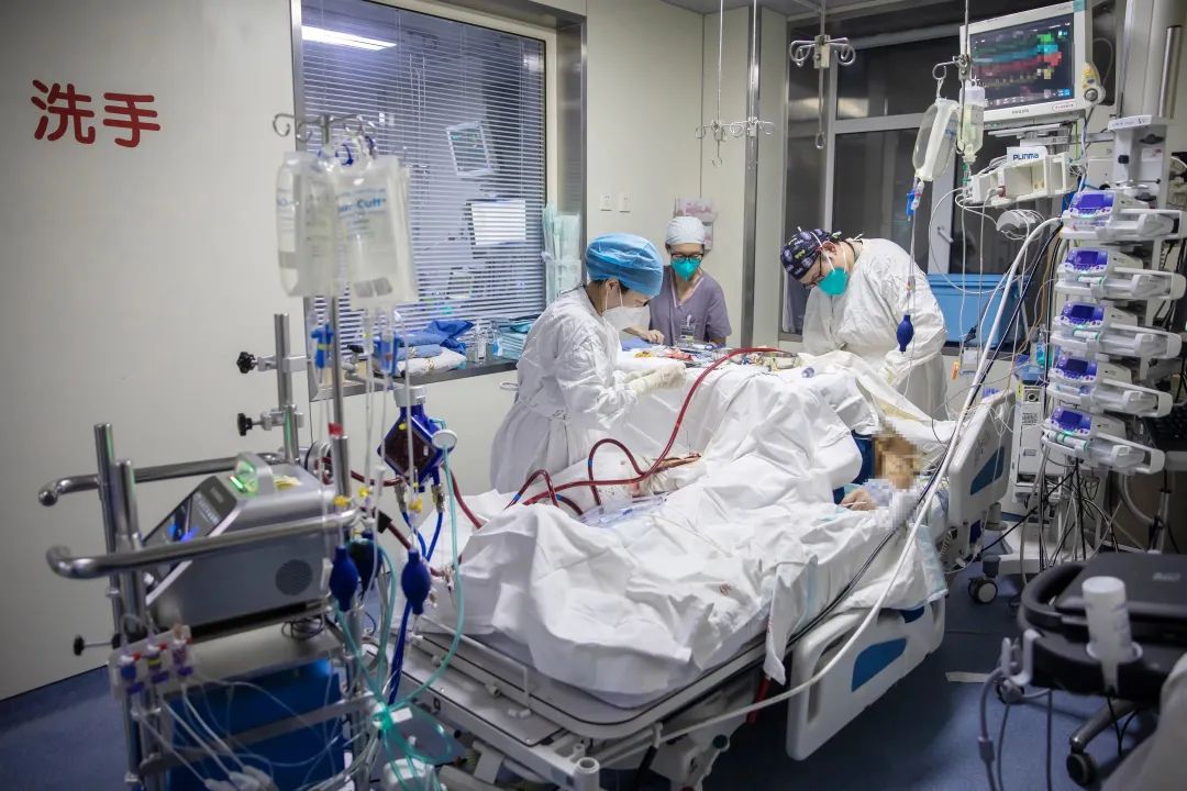 北京协和医院内科icu医护人员使用国产ecmo救治患者(临床试验阶段)