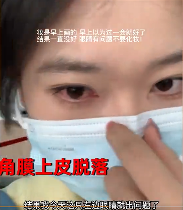 女生熬夜打游戏角膜上皮脱落!医生称严重需手术换角膜:一定要控制