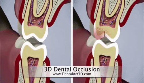 ▲图源：DentalArt3D