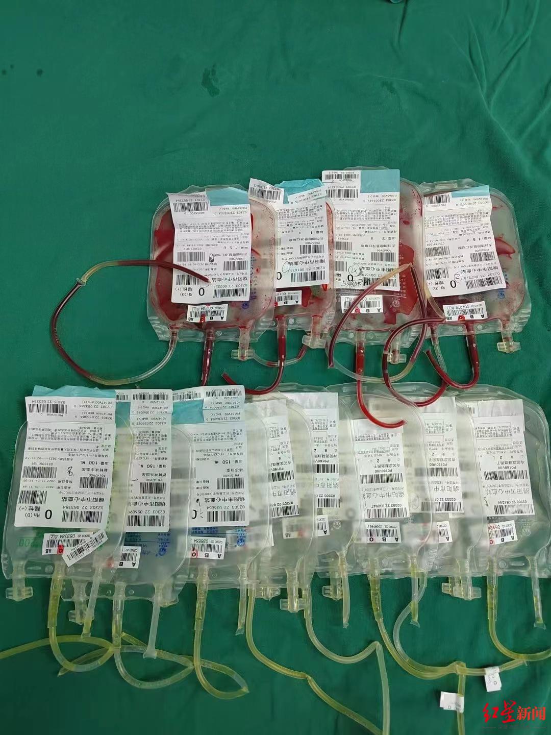 ↑共输血12袋共计3500毫升