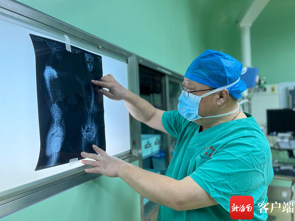 上海市第六人民医院小儿骨科主任,骨科专家陈博昌教授介绍小香的矫正