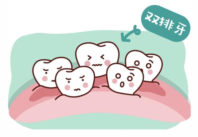 儿童换牙那些事儿