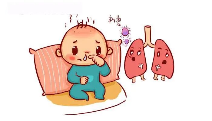 小儿肺炎在临床上属于急重症,急性发作期除了常规西医治疗,还可根据不