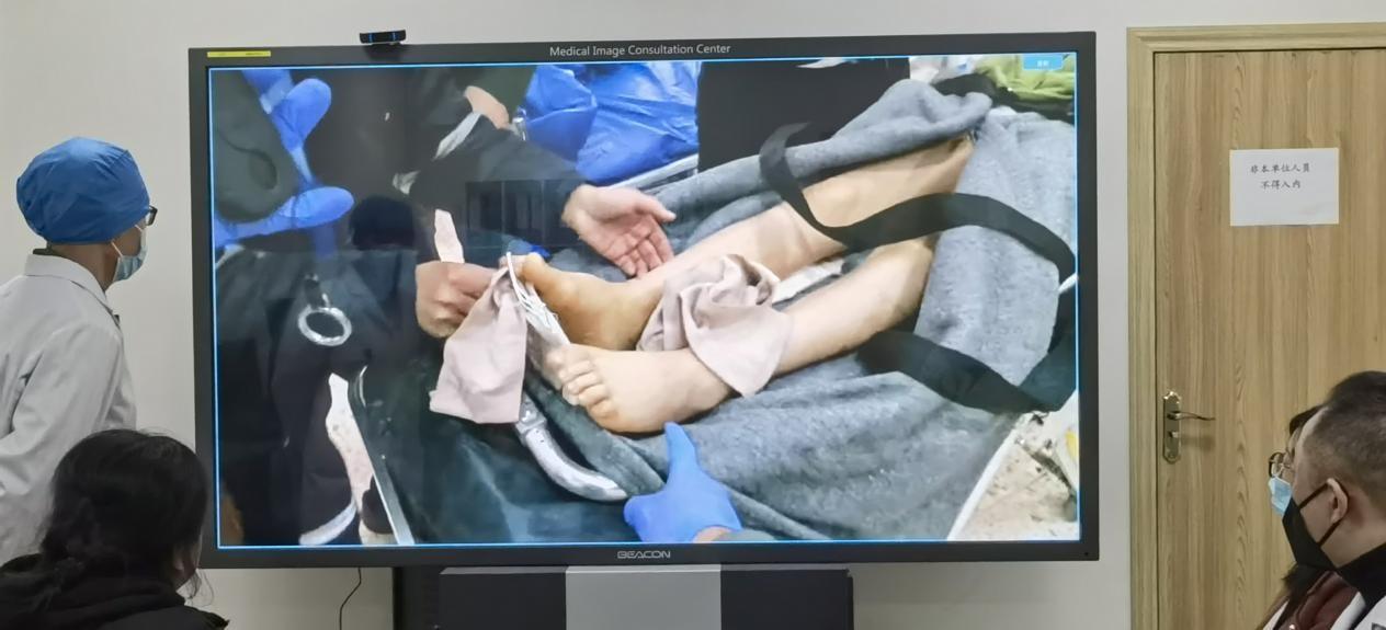 　　成都市七医院医生参与远程会诊