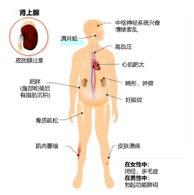 　　图：临床主要症状