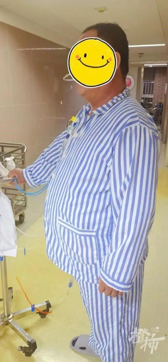 減肥手術(shù)哪種效果好_減肥手術(shù)有什么危害_手術(shù)減肥