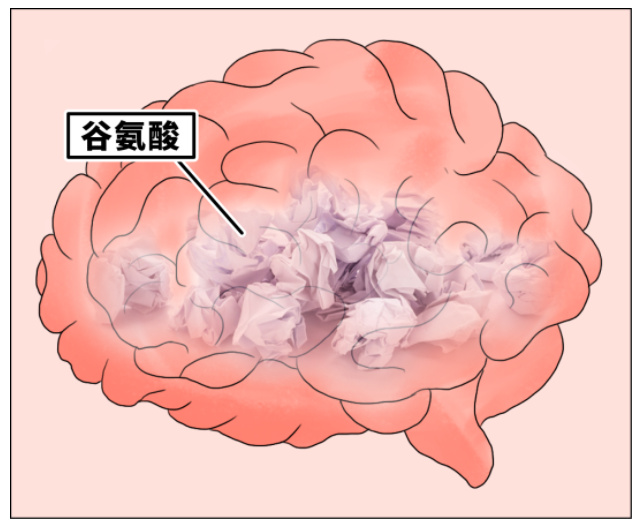 堆积的谷氨酸如果不及时清理,会成为一种代谢负担,影响后续信息的正常